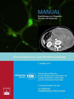 cover image of Knochentumoren und Weichteilsarkome